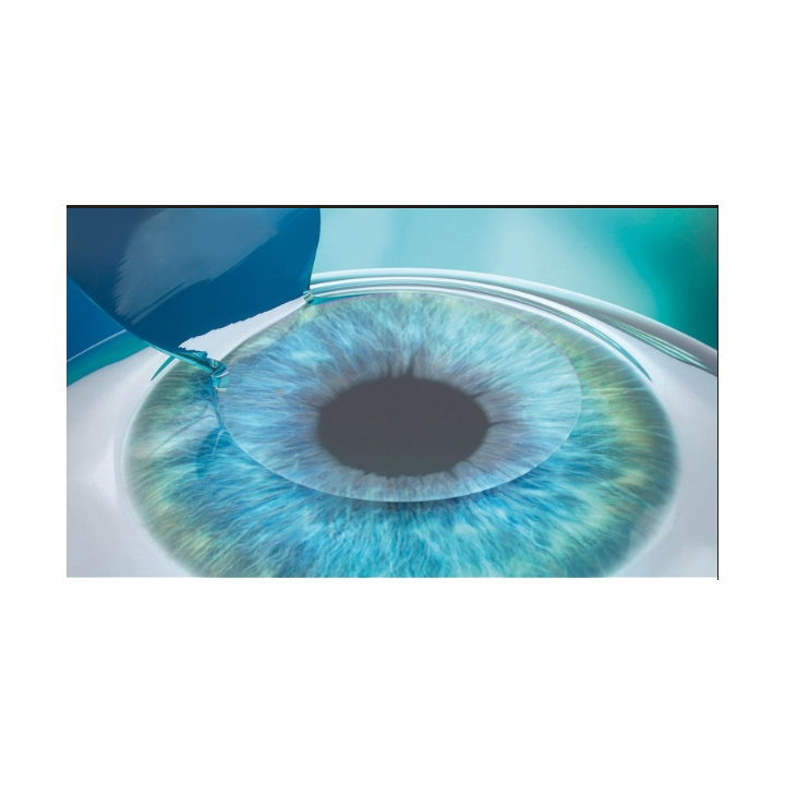 lasik 2